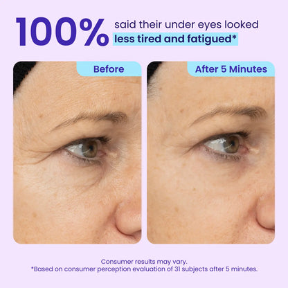 NEW! Instant Lift Eye Gel - For Puffiness & Bags, Wrinkles, Fine Lines and Dark Circles, Anti Aging Skin Care for Men & Women with Collagen Targeting Biotech