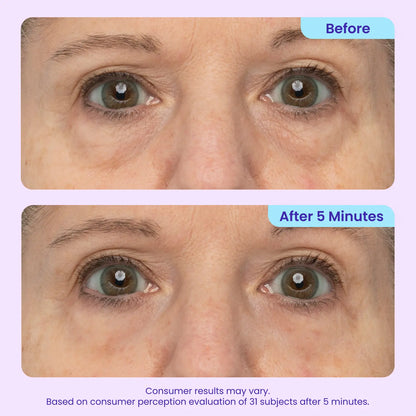 NEW! Instant Lift Eye Gel - For Puffiness & Bags, Wrinkles, Fine Lines and Dark Circles, Anti Aging Skin Care for Men & Women with Collagen Targeting Biotech