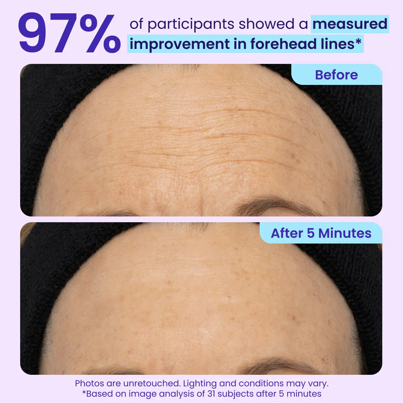 NEW! Instant Lift Eye Gel - For Puffiness & Bags, Wrinkles, Fine Lines and Dark Circles, Anti Aging Skin Care for Men & Women with Collagen Targeting Biotech