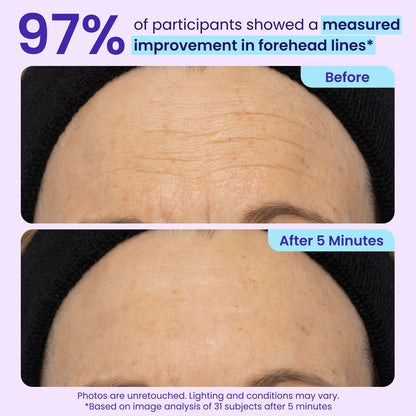 NEW! Instant Lift Eye Gel - For Puffiness & Bags, Wrinkles, Fine Lines and Dark Circles, Anti Aging Skin Care for Men & Women with Collagen Targeting Biotech